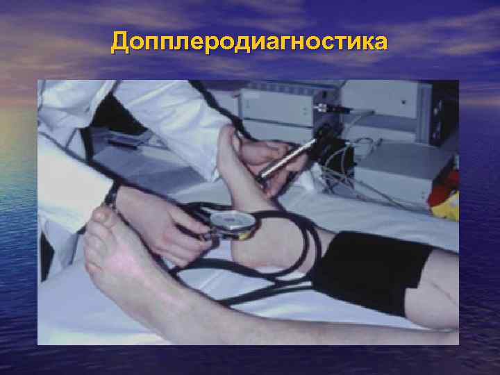 Допплеродиагностика 