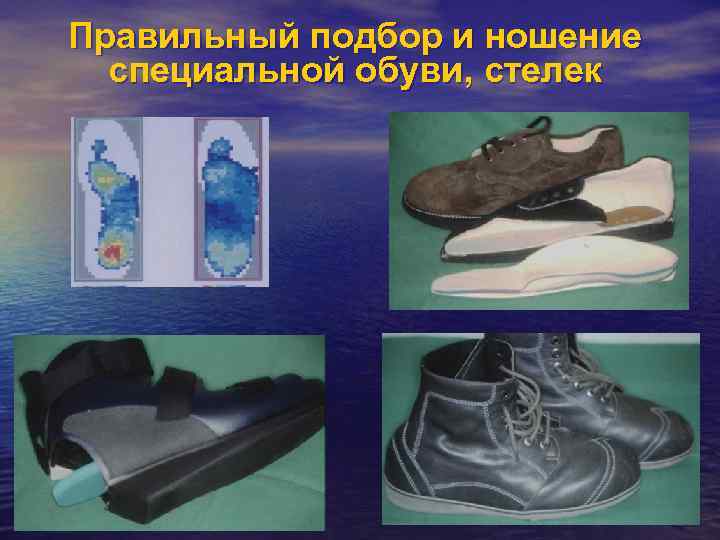 Правильный подбор и ношение специальной обуви, стелек 