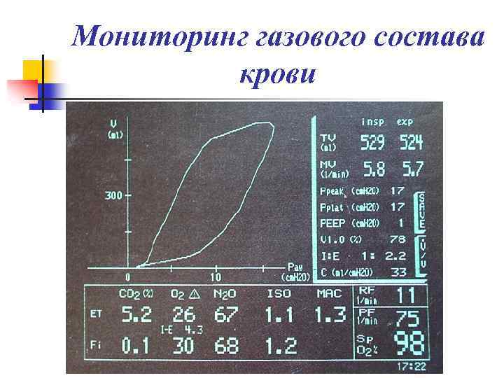 Мониторинг газового состава крови 
