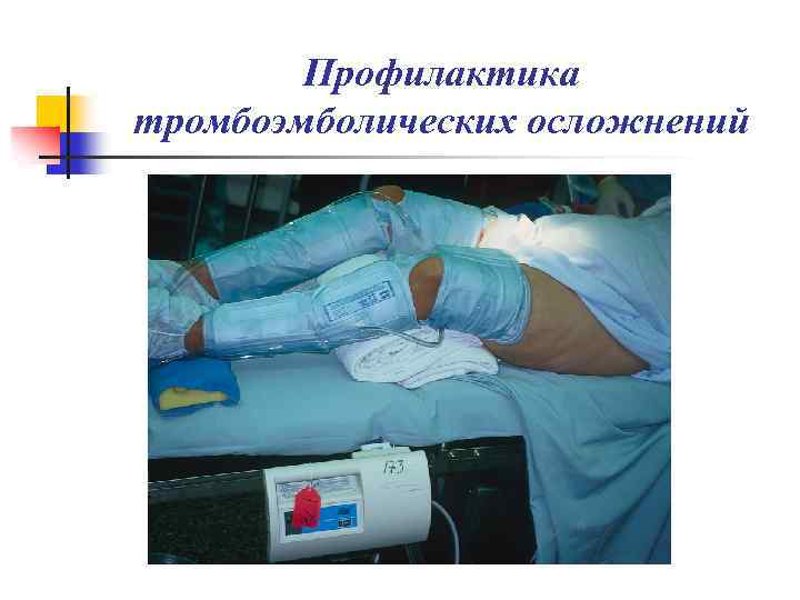 Профилактика тромбоэмболических осложнений 