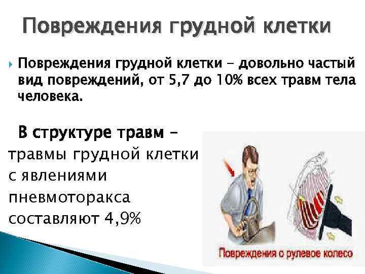 Травма грудной клетки лечение