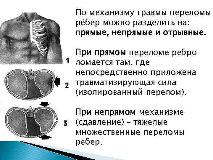 Презентация на тему травмы грудной клетки