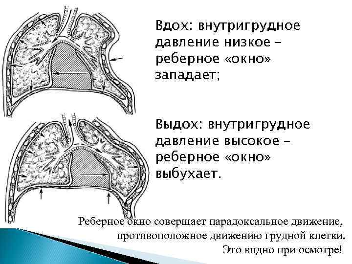 Ушиб грудной клетки код по мкб 10