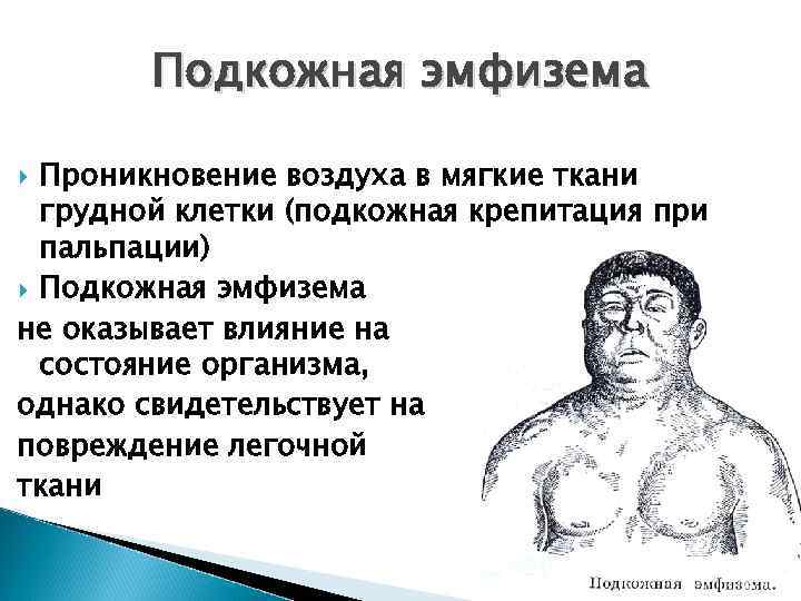 Состояние грудной клетки. Подкожная эмфизема симптомы. Эмфизема подкожной клетчатки. Проявления подкожной эмфиземы.