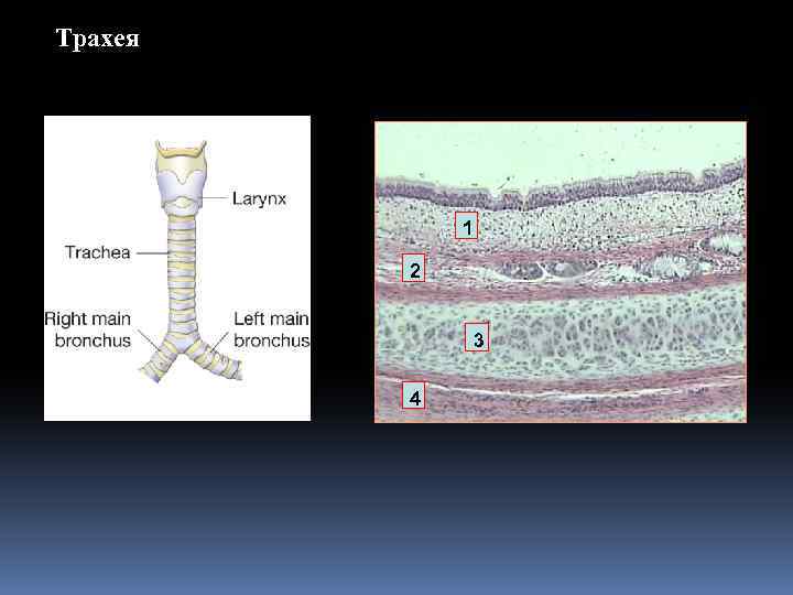 Трахея 1 2 3 4 