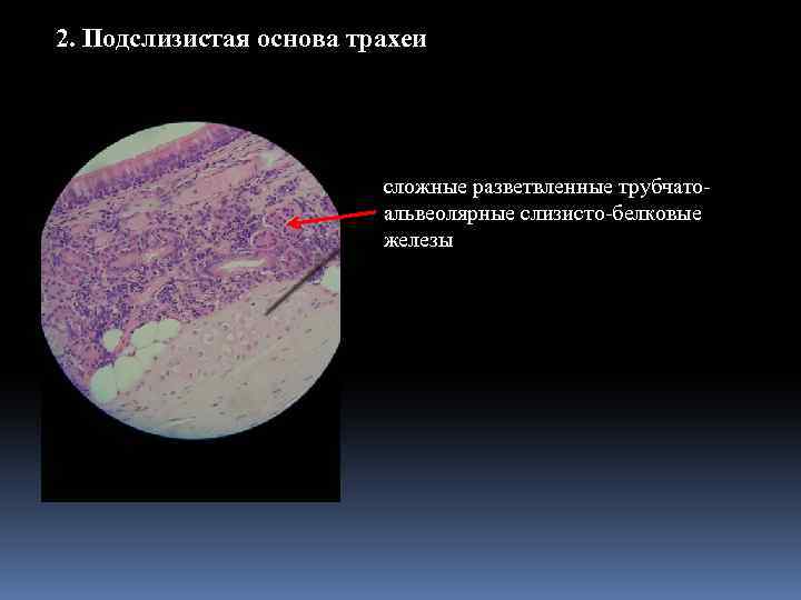 2. Подслизистая основа трахеи сложные разветвленные трубчатоальвеолярные слизисто-белковые железы 