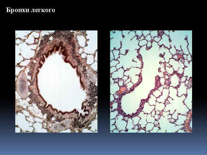 Бронхи легкого 