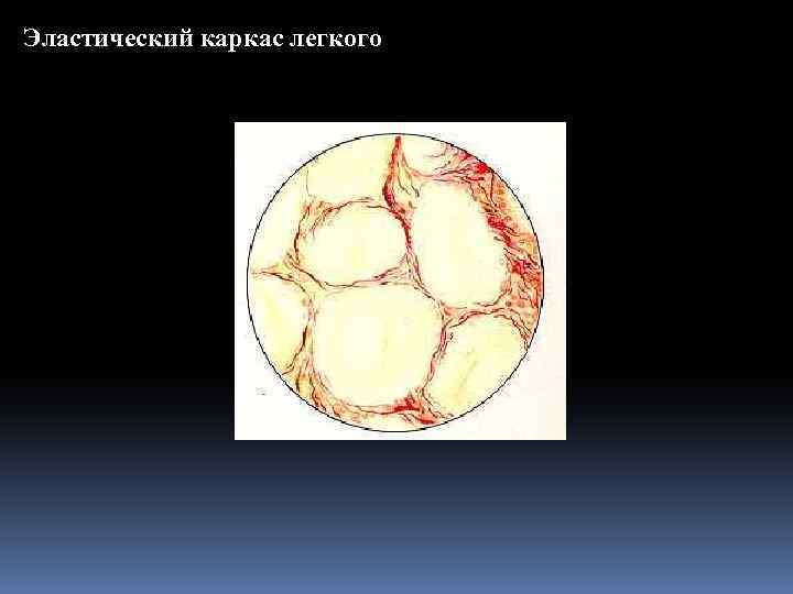 Эластический каркас легкого 