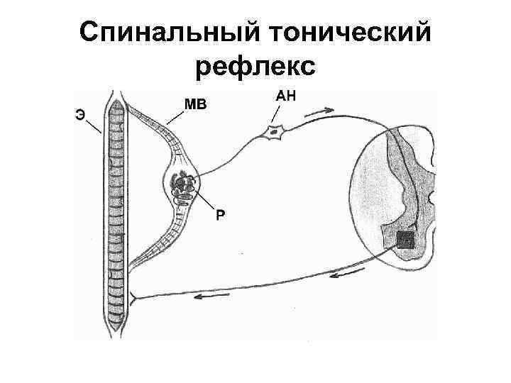 Спинальный тонический рефлекс 