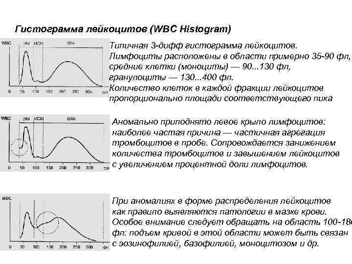 Гистограмма лейкоцитов (WBC Histogram) Типичная 3 -дифф гистограмма лейкоцитов. Лимфоциты расположены в области примерно