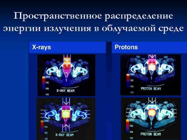 Пространственное распределение энергии излучения в облучаемой среде 