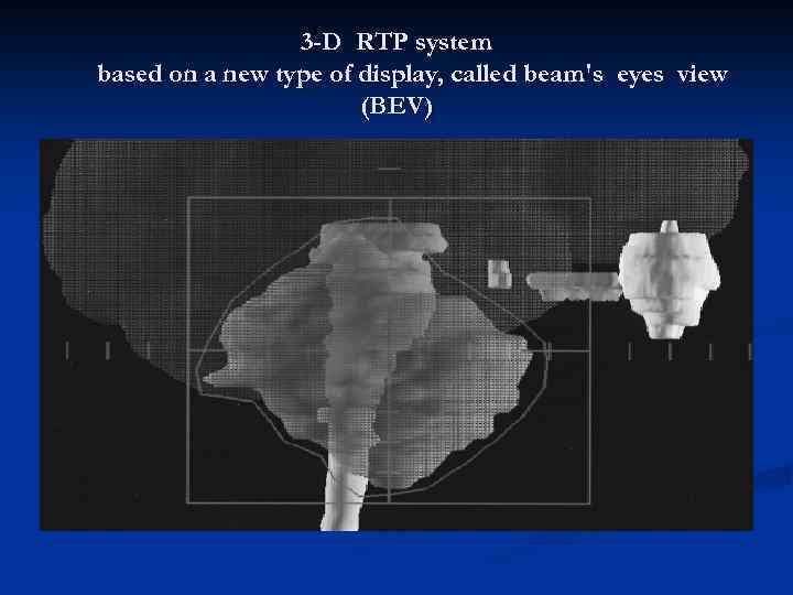 3 -D RTP system based on a new type of display, called beam's eyes