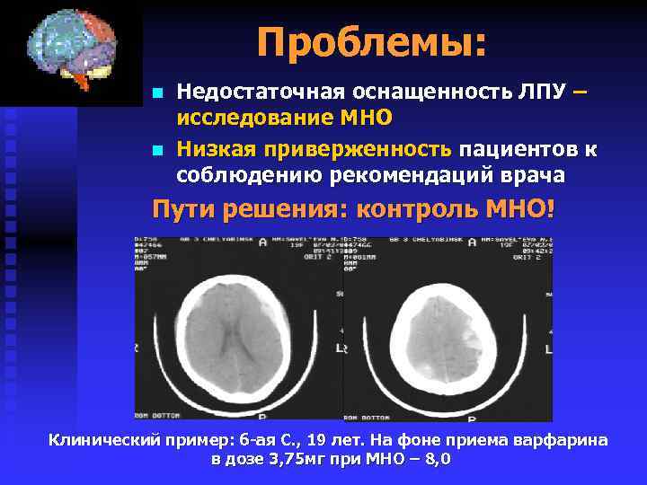Проблемы: n n Недостаточная оснащенность ЛПУ – исследование МНО Низкая приверженность пациентов к соблюдению