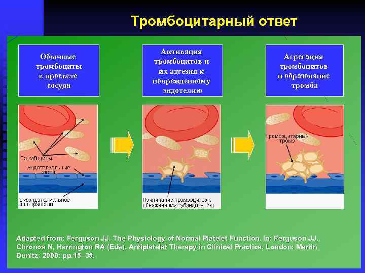 Презентация на тему тромбоз эмболия