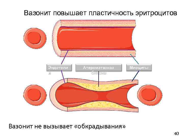 Вазонит повышает пластичность эритроцитов Эндотели й Атероматозная бляшка Вазонит не вызывает «обкрадывания» Миоциты 40