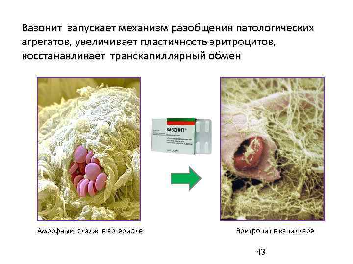 Вазонит запускает механизм разобщения патологических агрегатов, увеличивает пластичность эритроцитов, восстанавливает транскапиллярный обмен Аморфный сладж