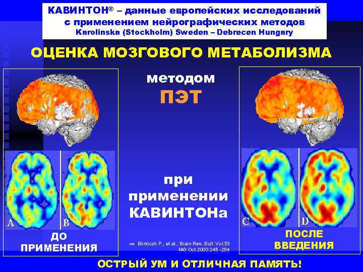 КАВИНТОН® – данные европейских исследований с применением нейрографических методов Karolinska (Stockholm) Sweden – Debrecen