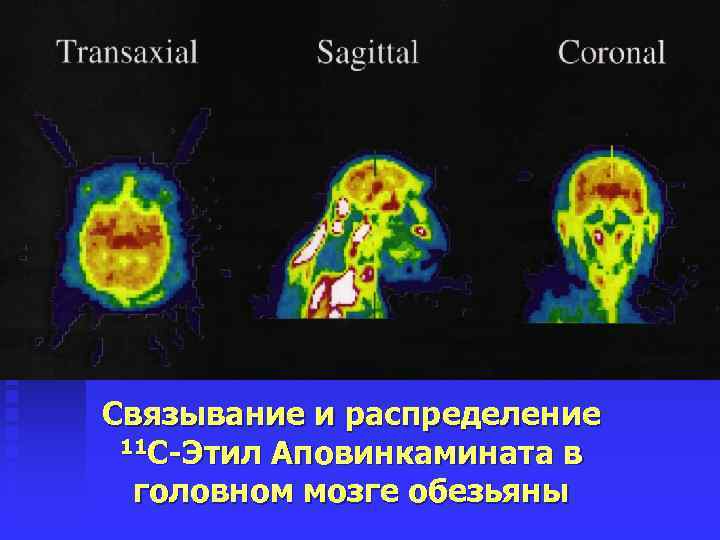 Связывание и распределение 11 C-Этил Аповинкамината в головном мозге обезьяны 