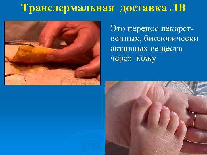 Трансдермальная доставка ЛВ Это перенос лекарственных, биологически активных веществ через кожу 