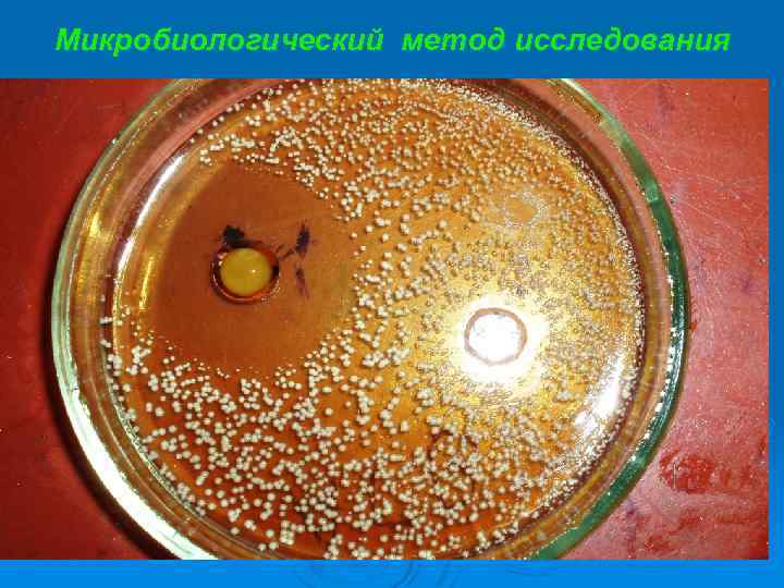 Микробиологический метод исследования 