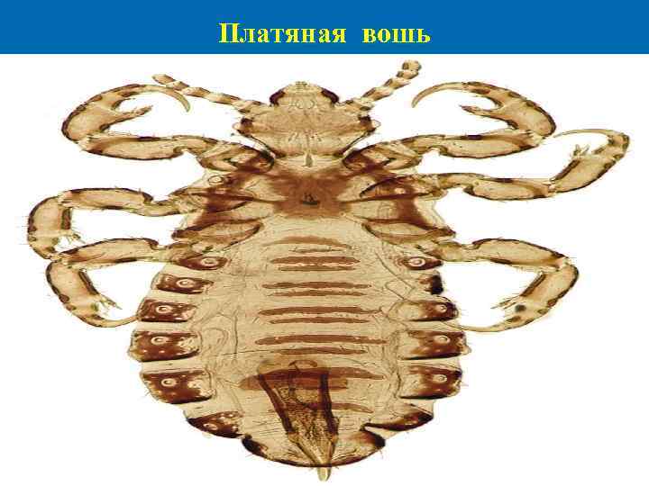 Платяная вошь 