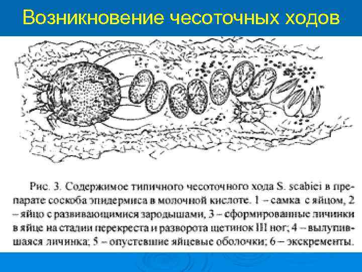 Возникновение чесоточных ходов 