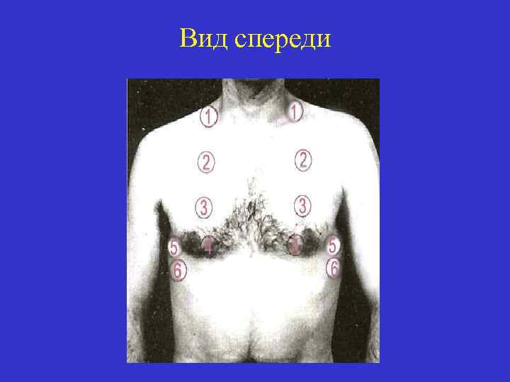 Вид спереди 