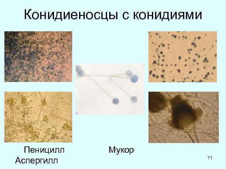 Конидиеносцы с конидиями Пеницилл Мукор Аспергилл 11 