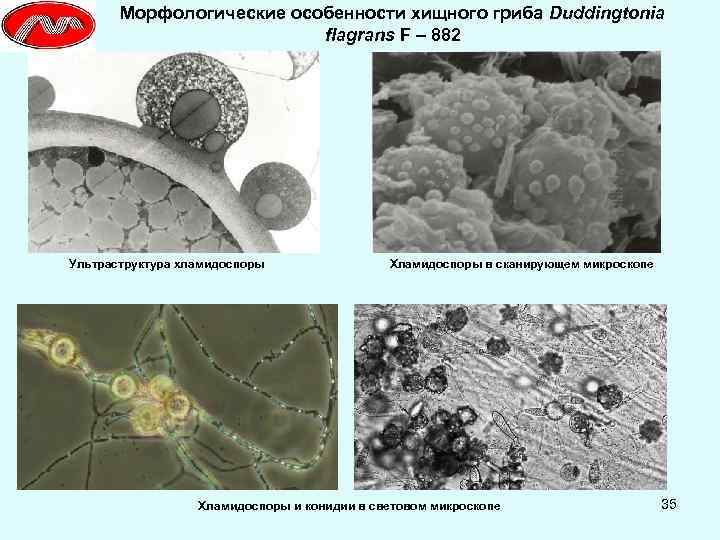 Морфологические особенности хищного гриба Duddingtonia flagrans F – 882 Ультраструктура хламидоспоры Хламидоспоры в сканирующем