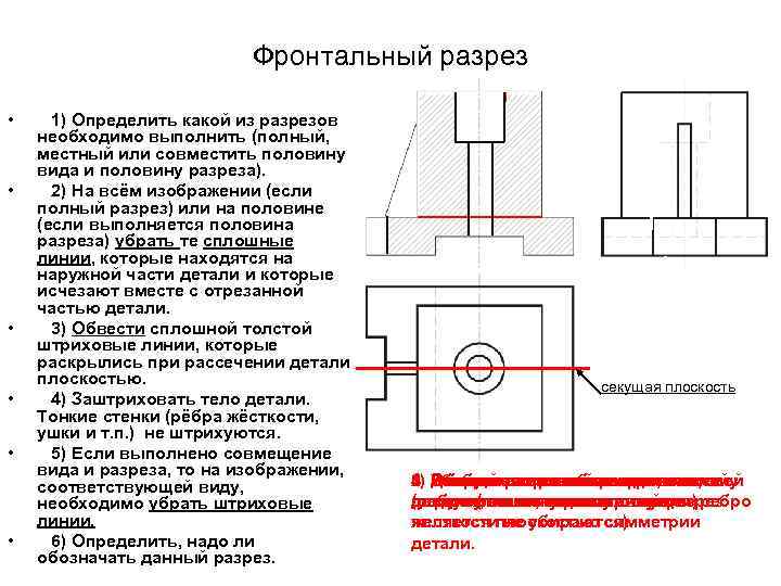 Фронтальный разрез изображение