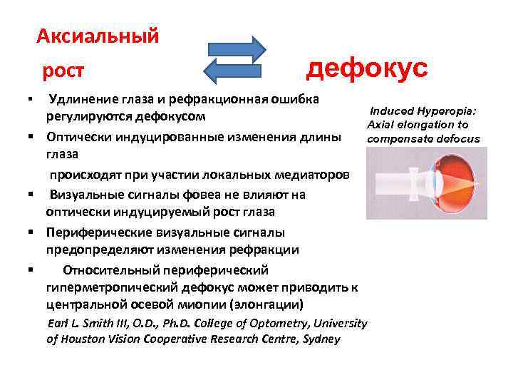  Аксиальный рост дефокус § Удлинение глаза и рефракционная ошибка регулируются дефокусом Induced Hyperopia: