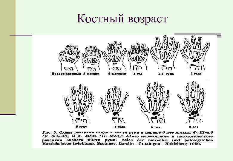 Костный возраст 