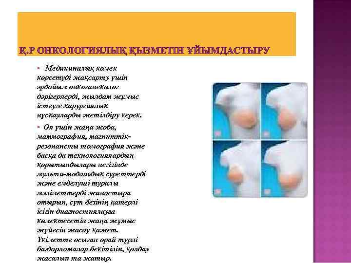 Қ. Р ОНКОЛОГИЯЛЫҚ ҚЫЗМЕТІН ҰЙЫМДАСТЫРУ Медициналық көмек көрсетуді жақсарту үшін әрдайым онкогинеколог дәрігерлерді, жылдам