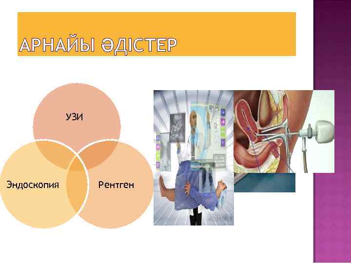 АРНАЙЫ ӘДІСТЕР УЗИ Эндоскопия Рентген 
