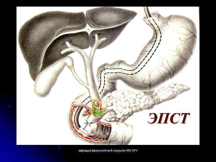 кафедра факультетской хирургии МИ ЯГУ 