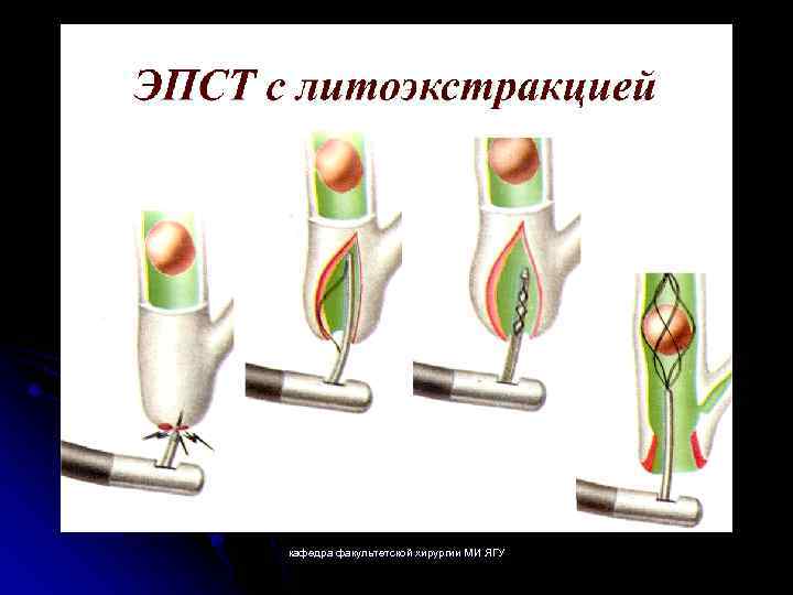 кафедра факультетской хирургии МИ ЯГУ 