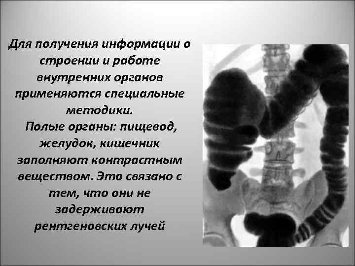Для получения информации о строении и работе внутренних органов применяются специальные методики. Полые органы: