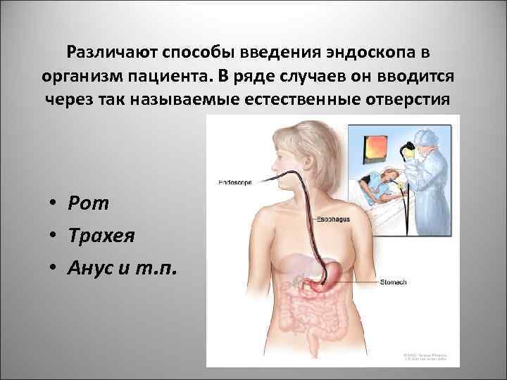 Различают способы введения эндоскопа в организм пациента. В ряде случаев он вводится через так