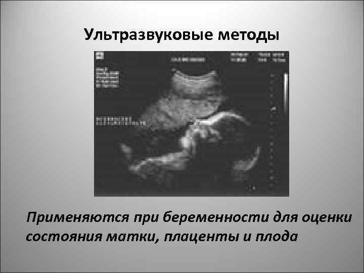 Ультразвуковые методы Применяются при беременности для оценки состояния матки, плаценты и плода 