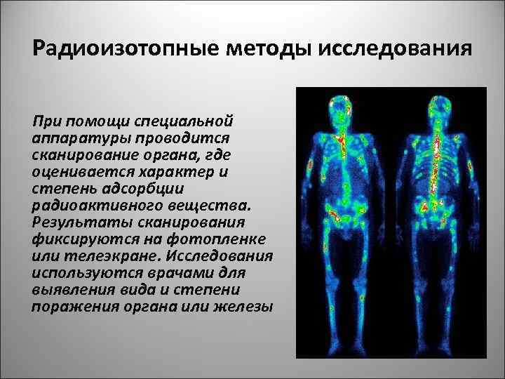 Негативное изображение исследуемого органа на фотопленке