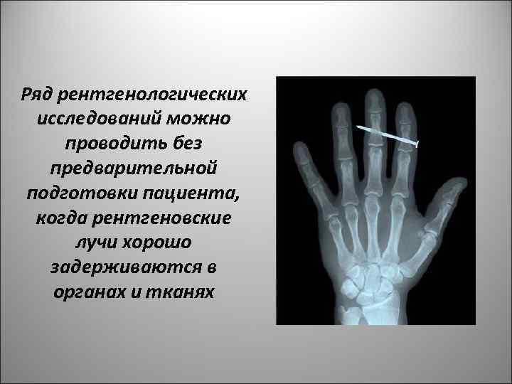 Ряд рентгенологических исследований можно проводить без предварительной подготовки пациента, когда рентгеновские лучи хорошо задерживаются