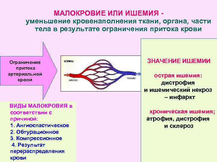 МАЛОКРОВИЕ ИЛИ ИШЕМИЯ уменьшение кровенаполнения ткани, органа, части тела в результате ограничения притока крови