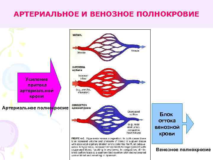 Нарушения кровенаполнения блок схема