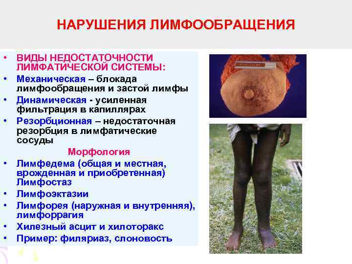 НАРУШЕНИЯ ЛИМФООБРАЩЕНИЯ • ВИДЫ НЕДОСТАТОЧНОСТИ ЛИМФАТИЧЕСКОЙ СИСТЕМЫ: • Механическая – блокада лимфообращения и застой