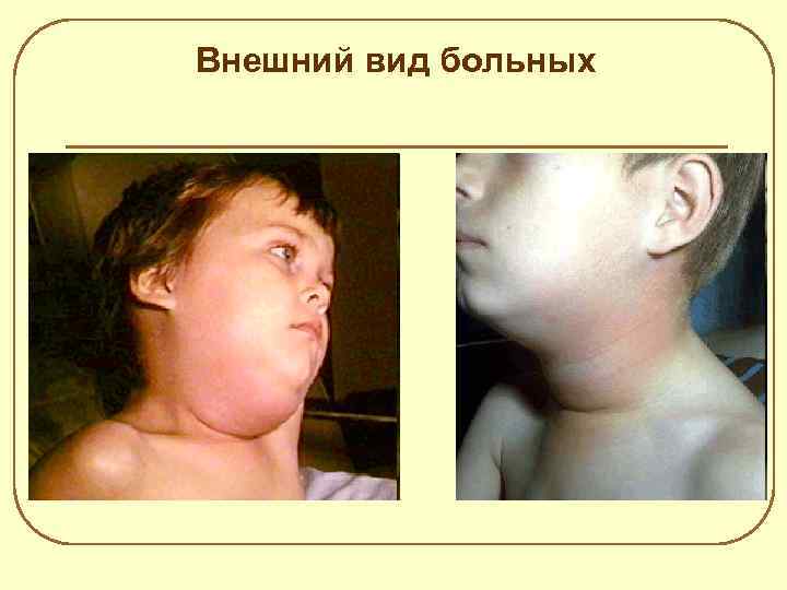 Внешний вид больных 