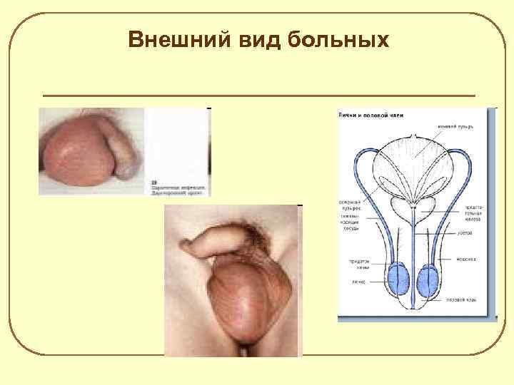 Внешний вид больных 