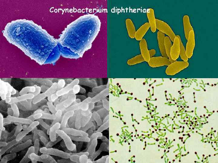 Corynebacterium diphtheriae 