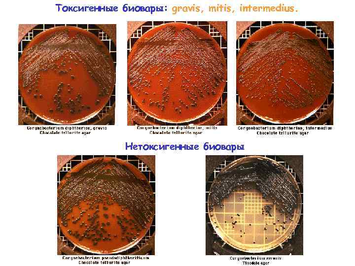 Токсигенные биовары: gravis, mitis, intermedius. Нетоксигенные биовары 