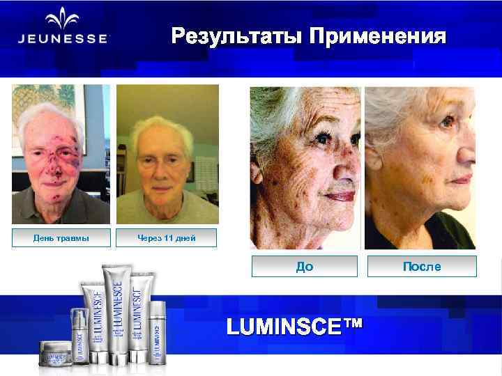 Результаты Применения День травмы Через 11 дней До LUMINSCE™ После 