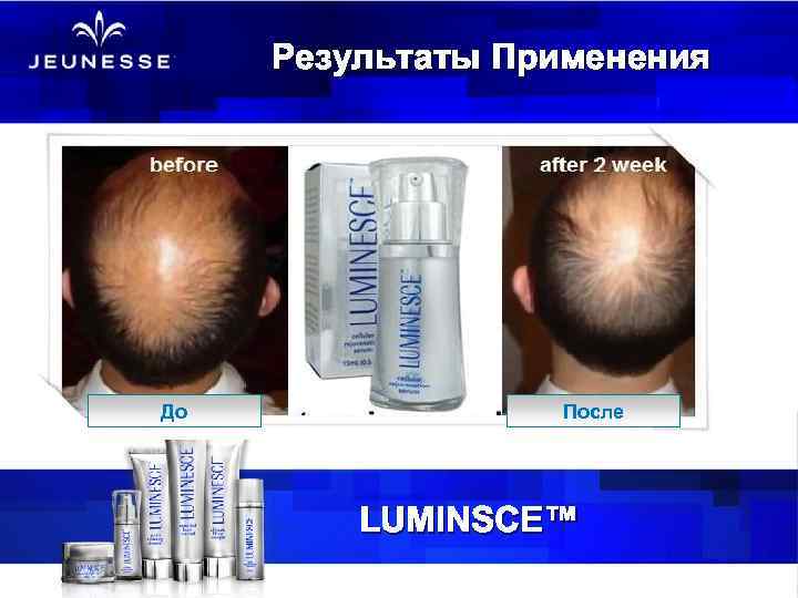 Результаты Применения До После LUMINSCE™ 